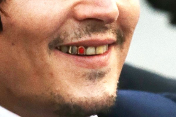 De tanden van Johnny Depp