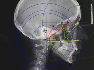 Telegentogram - foto van een menselijk hoofd