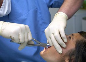 Wat de dokter zal doen na het trekken van de tanden