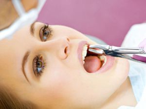 Tand extractie Symptomen van hyperdontie