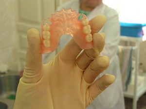 Nylon prothesen installeren
